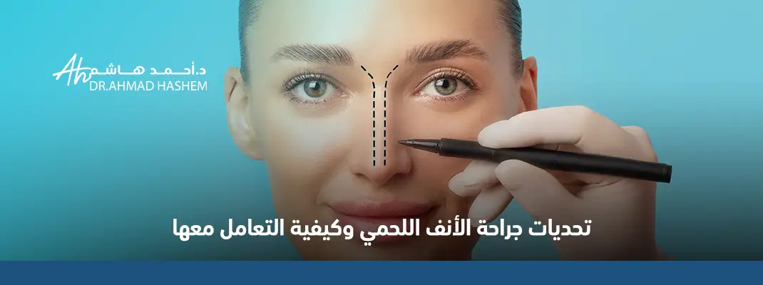 تحديات-جراحة-الأنف-اللحمي-وكيفية-التعامل-معها-01.webp