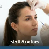 الحساسية الجلدية