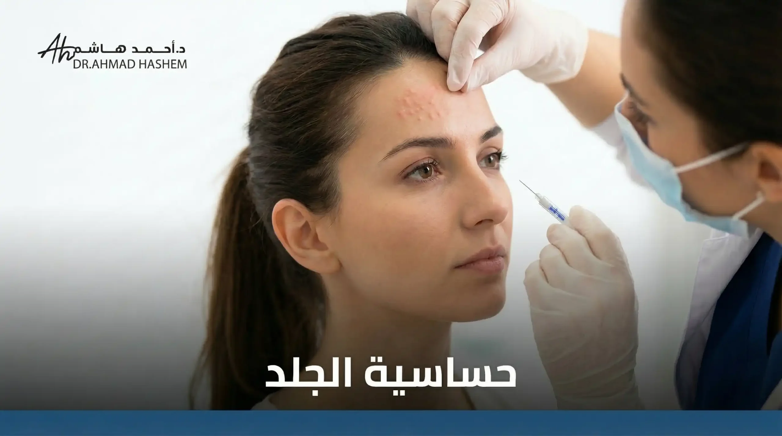 الحساسية الجلدية