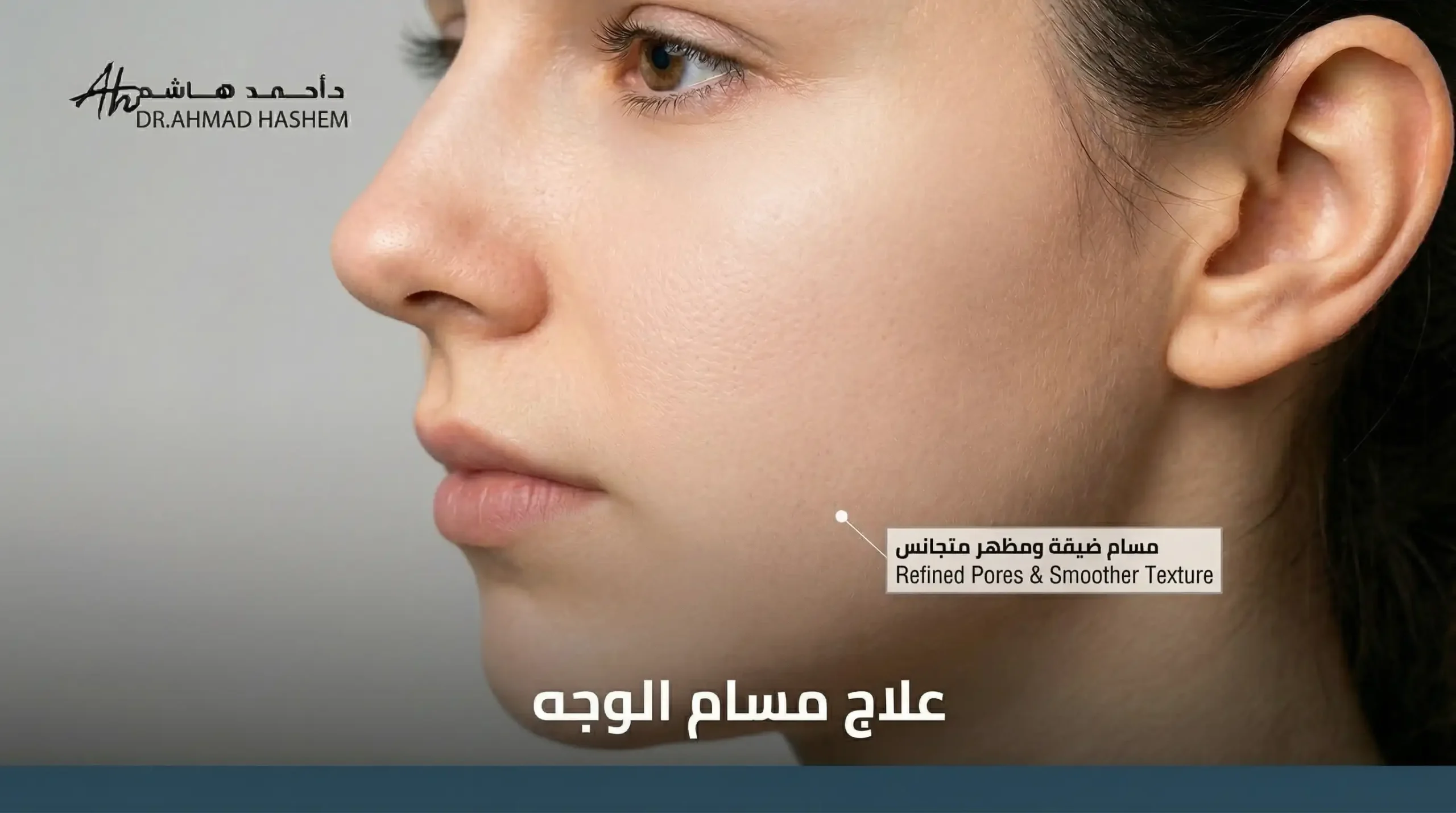 علاج المسامات بالوجه