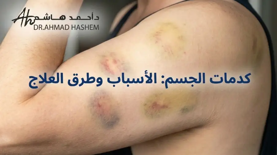 كدمات-الجسم.webp