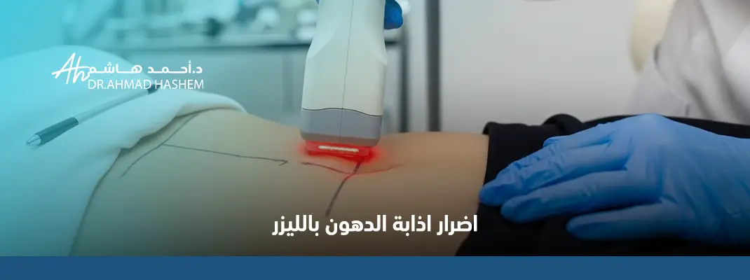 اضرار اذابة الدهون بالليزر