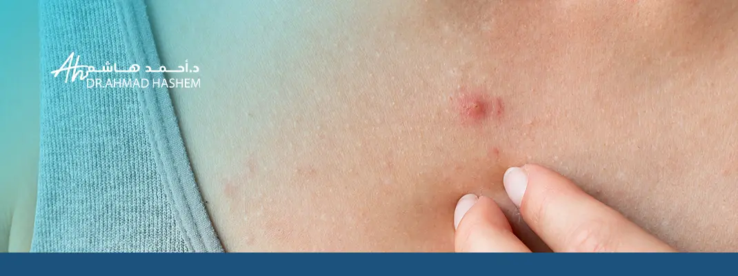 انواع الحبوب في الجسم مع الصور