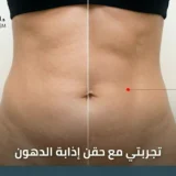 تجربتي مع إبر إذابة الدهون