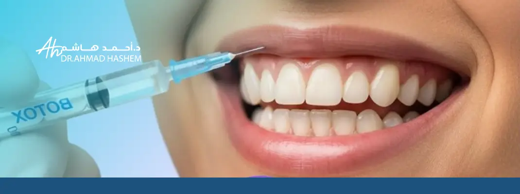 تجربتي مع البوتوكس