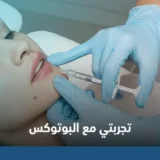 تجربتي مع البوتوكس
