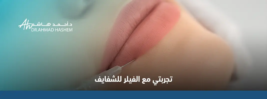 تجربتي مع فيلر الشفايف