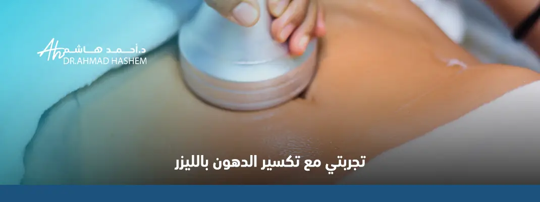 تجربتي مع تكسير الدهون بالليزر