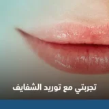 تجربتي مع توريد الشفايف​