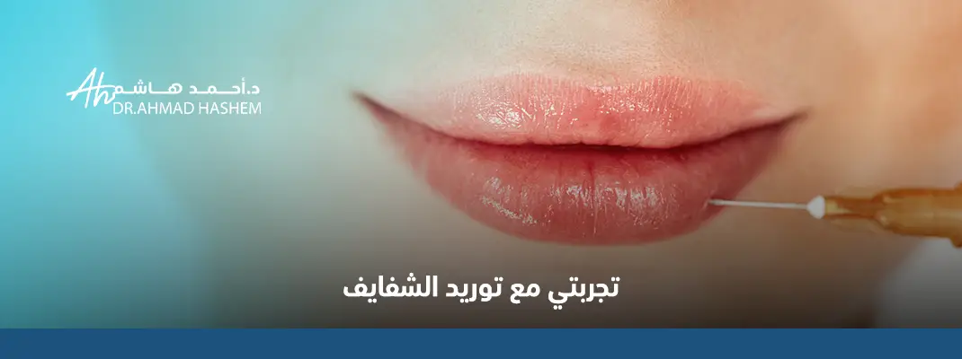 تجربتي مع توريد الشفايف​