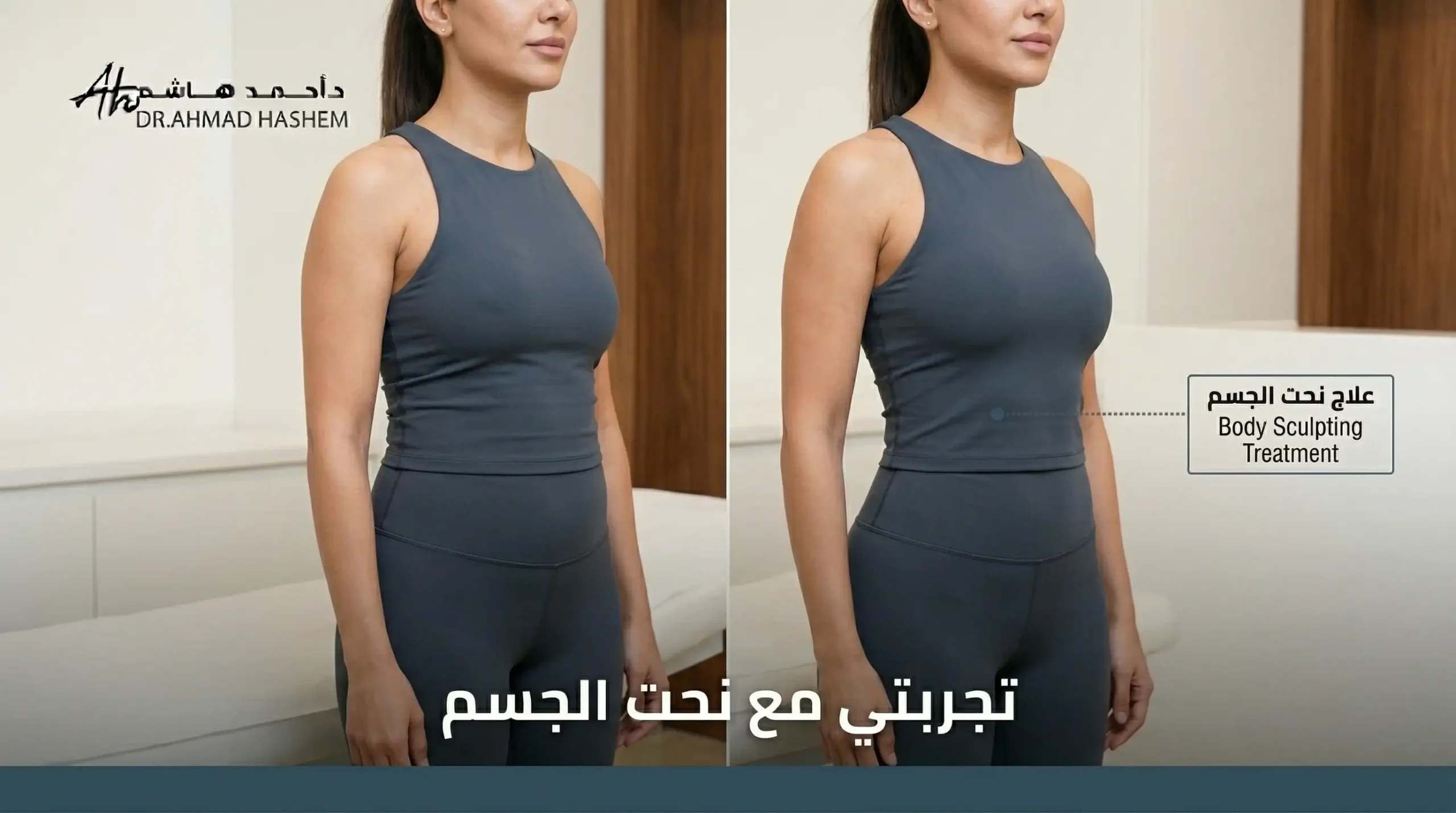 تجربتي مع عملية نحت الجسم