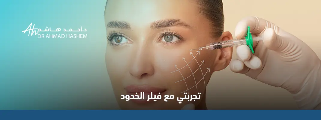 تجربتي مع فيلر الخدود