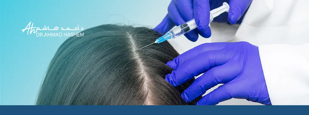 تجربتي مع فيلر الشعر