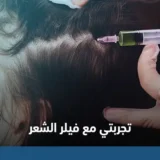 تجربتي مع فيلر الشعر