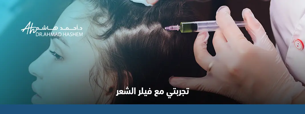 تجربتي مع فيلر الشعر