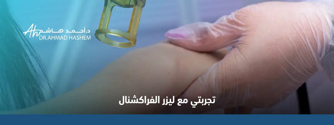 تجربتي مع ليزر الفراكشنال​ في جدة