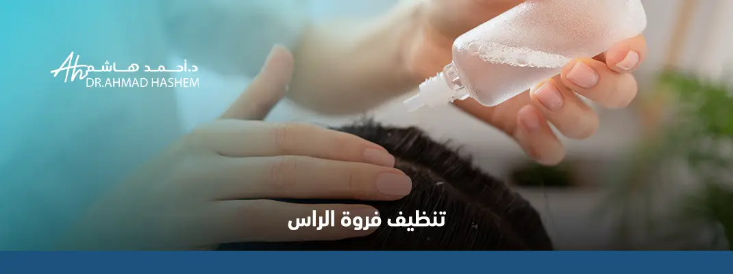 تنظيف-فروة-الراس.webp
