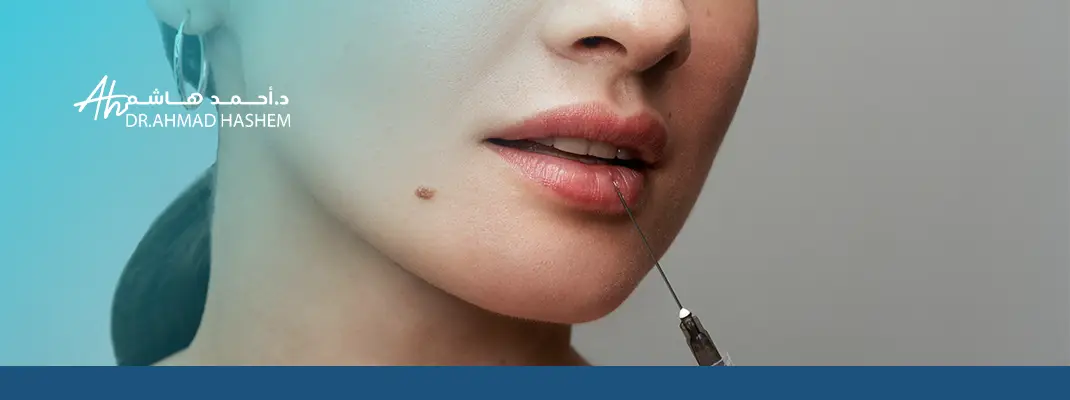 توريد الشفايف