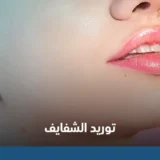 توريد الشفايف