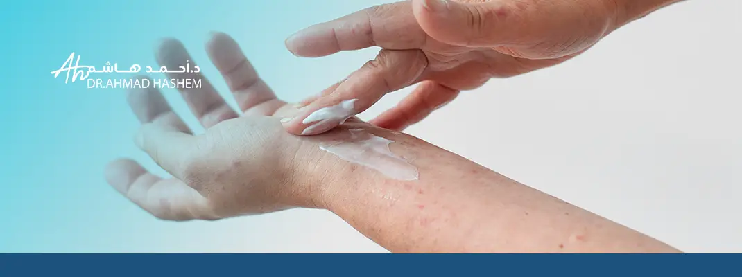 علاج حساسية الجلد
