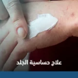 علاج حساسية الجلد