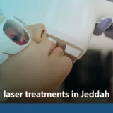 laser treatments in Jeddah