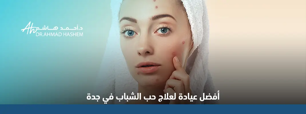 أفضل عيادة لعلاج حب الشباب وآثاره في جدة