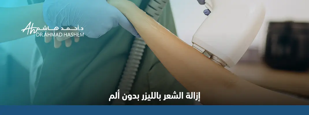 إزالة الشعر بالليزر بدون ألم