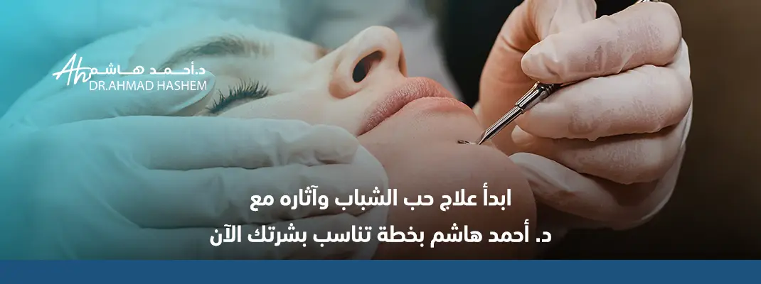 ابدأ علاج حب الشباب وآثاره مع د. أحمد هاشم بخطة تناسب بشرتك الآن الآن.