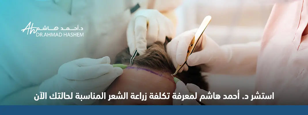 استشر د. أحمد هاشم لمعرفة تكلفة زراعة الشعر المناسبة لحالتك الآن 01