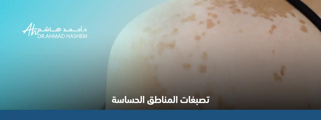 علاج تصبغات المناطق الحساسة