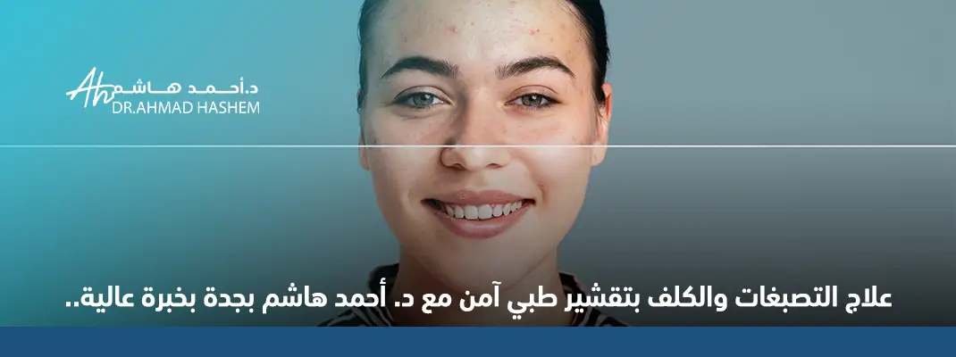 علاج التصبغات والكلف بتقشير طبي آمن مع د. أحمد هاشم بجدة بخبرة عالية.. 01