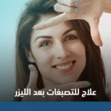 أفضل علاج للتصبغات والكلف