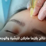 نتائج بلازما ماجلان للبشرة والوجه