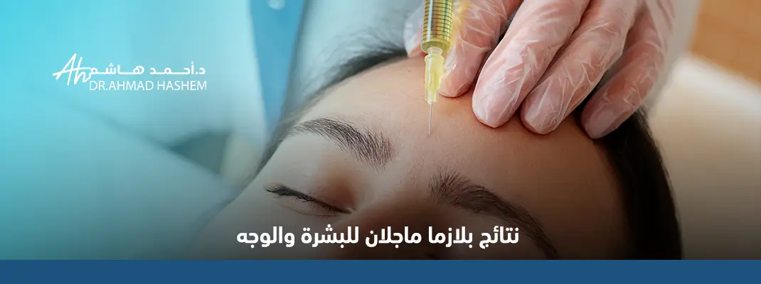 نتائج بلازما ماجلان للبشرة والوجه