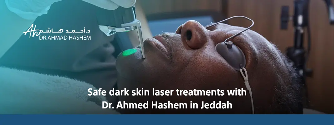 laser hair removal for dark skin jeddah