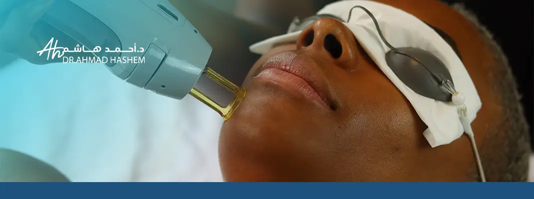 Safe dark skin laser treatments with Dr. Ahmed Hashem in Jeddah