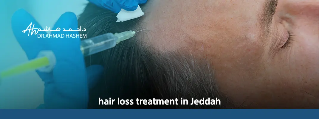 hair-loss-treatment-in-Jeddah.webp