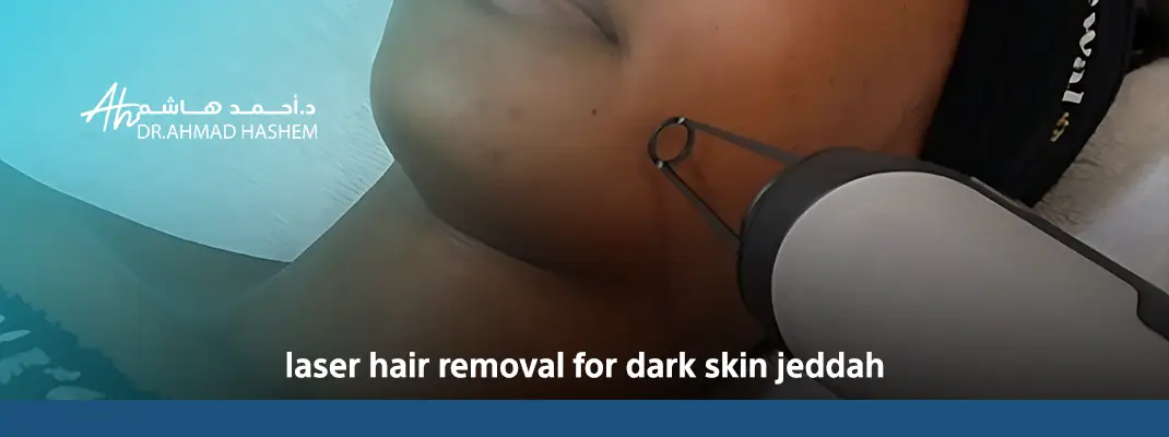 laser hair removal for dark skin jeddah