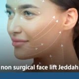 non surgical face lift Jeddah
