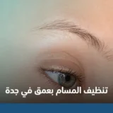 تنظيف المسام بعمق في جدة