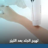 تهيج الجلد بعد الليزر