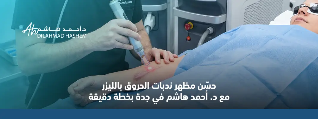 حسّن مظهر ندبات الحروق بالليزر مع د. أحمد هاشم في جدة بخطة دقيقة