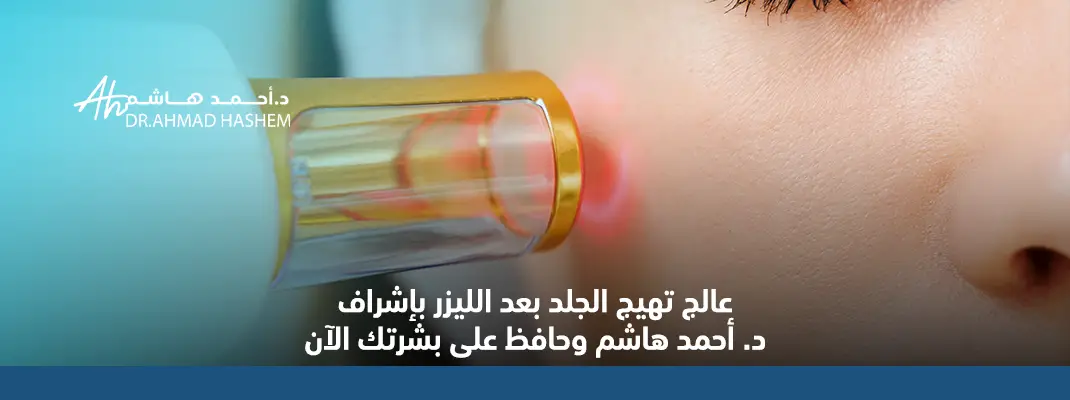 عالج تهيج الجلد بعد الليزر بإشراف د. أحمد هاشم وحافظ على بشرتك الآن