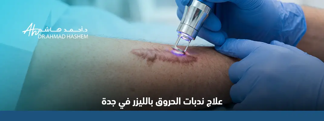 علاج-ندبات-الحروق-بالليزر-في-جدة.webp
